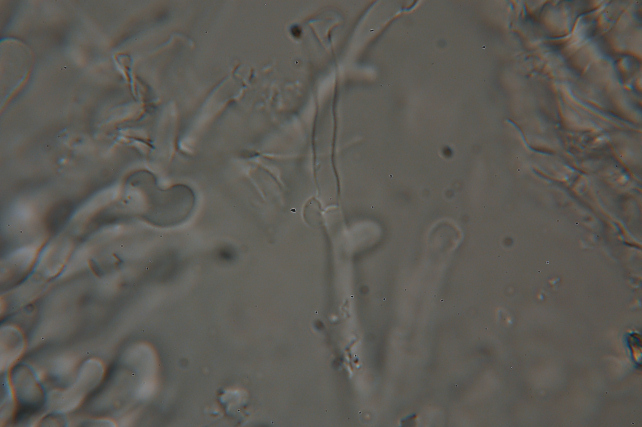 lignicolo da determinare (Hyphoderma radula)